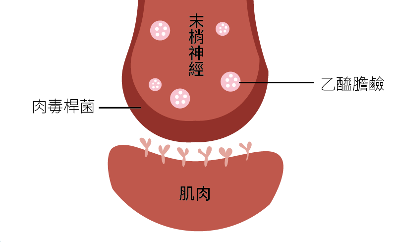 肉毒桿菌素作用原理