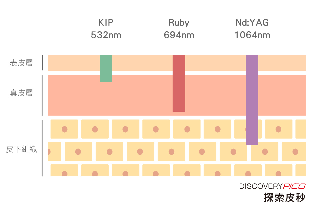 皮秒雷射三種波長
