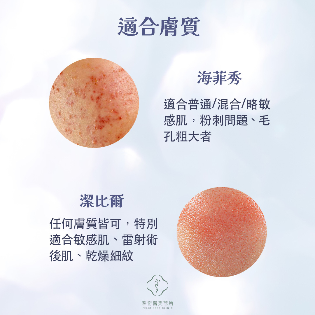 海菲秀、潔比爾適合膚質與需求