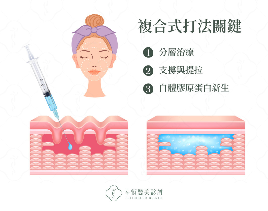 複合式打法關鍵