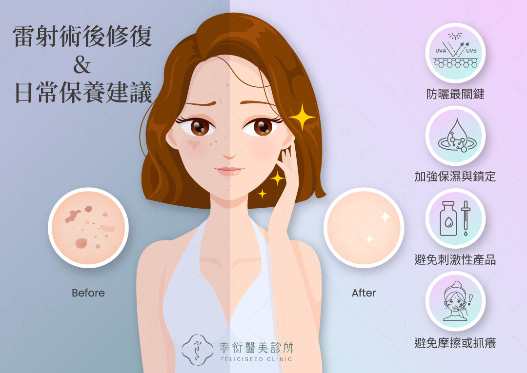 術後修復與日常保養建議