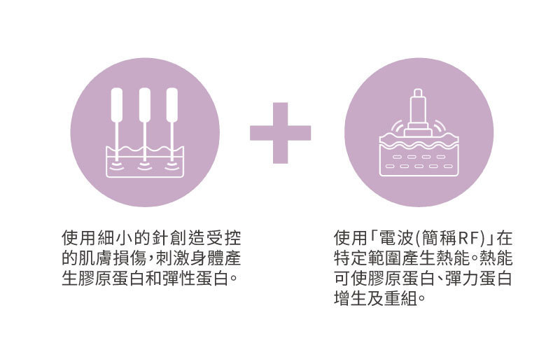 什麼是微針電波?