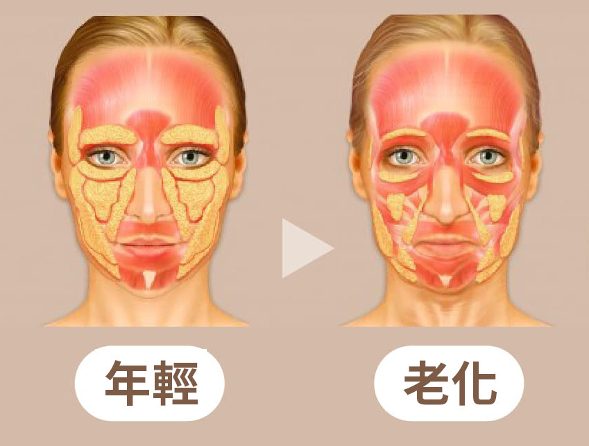 臉部脂肪流失過程-年輕VS老化