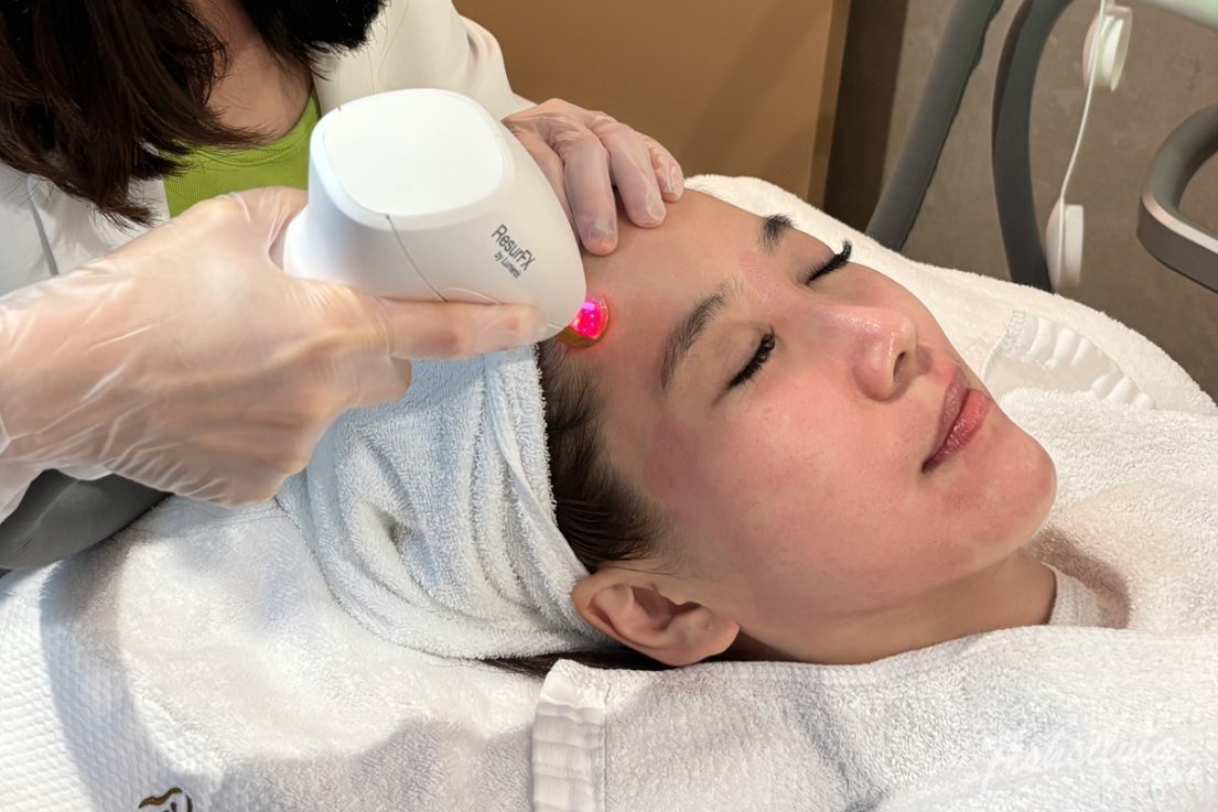 翁子玉醫師施打 梭時雷射