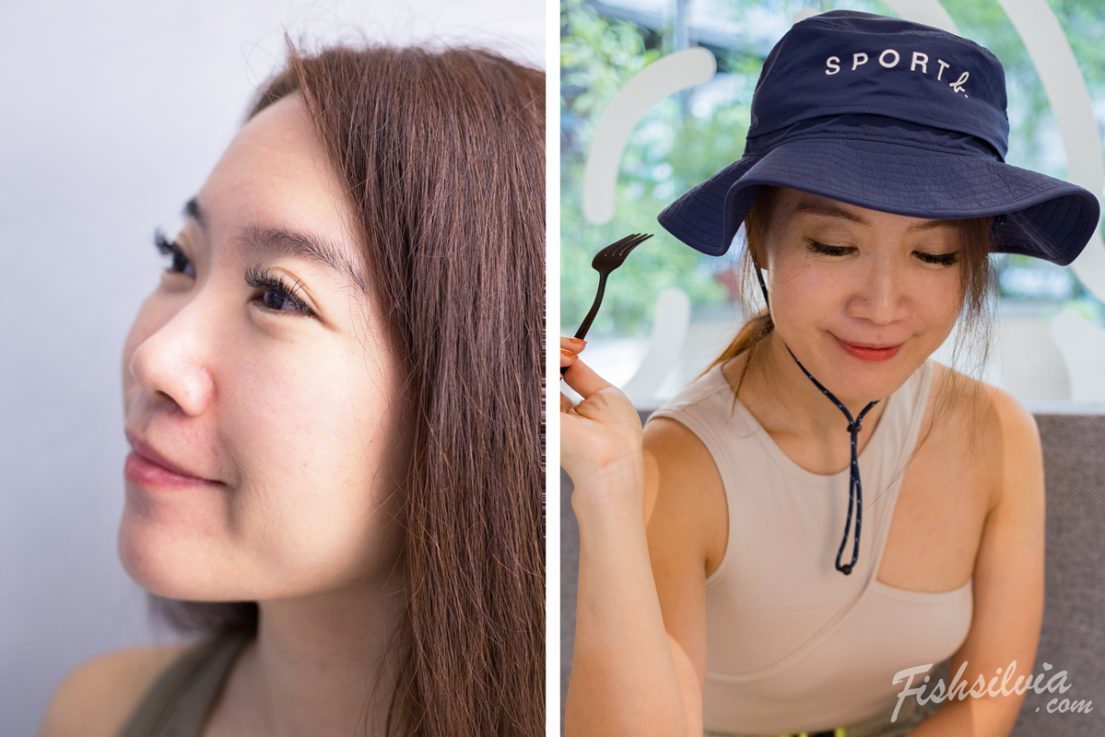 心動光+梭時雷射 術後第21天