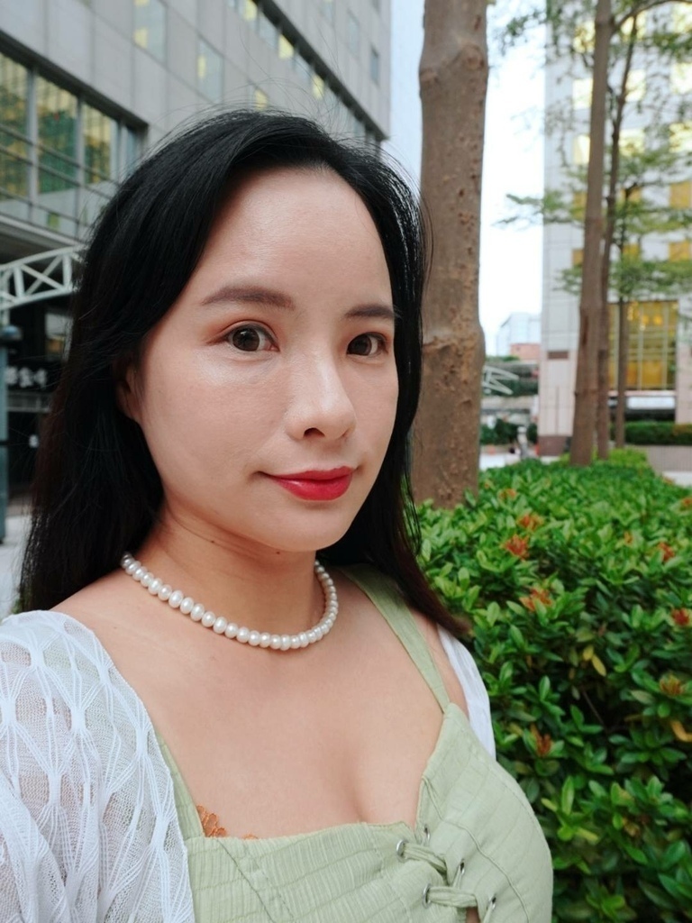 愛菲兒 奇肌肉毒體驗分享 肉毒術後